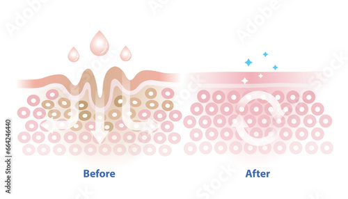 Before and after skincare absorption vector illustration isolated on white background. Cross section of wrinkles skin and skincare absorbing to help reduce aging and damaged skin. Skin care concept. photo