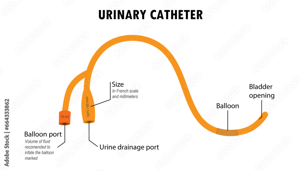 Urinary catheter diagram, how it is used, instructions Stock