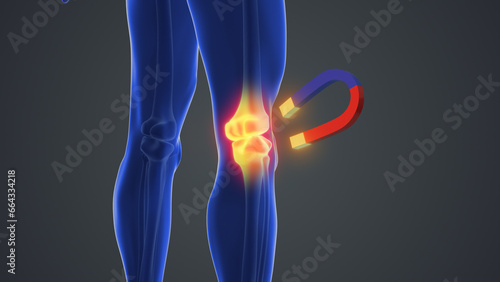 Magnet therapy for knee joint pain 