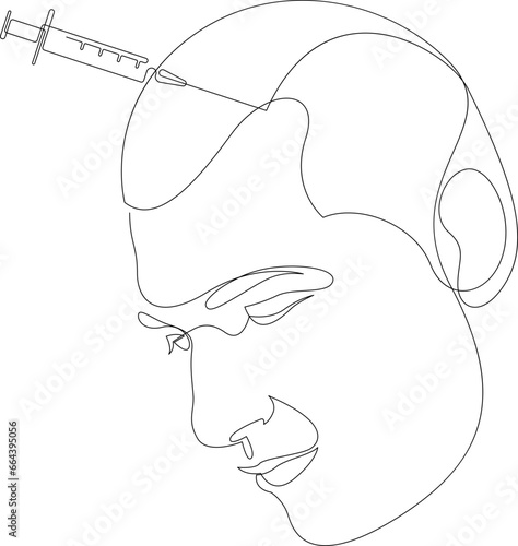 Continuous one line drawing of platelet rich plasma injection procedure for men. Male alopecia treatment concept minimal design. Hair growth stimulation drawn by single line. Vector illustration.