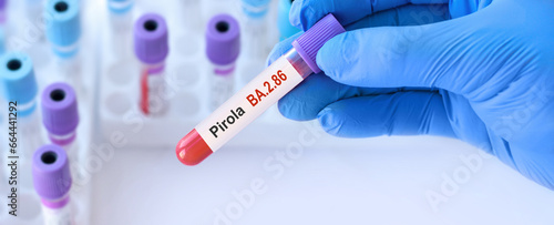 Doctor holding a test blood sample tube for the detection of the BA.2.86 Pirola on the background of medical test tubes.New Covid 19 Pirola Variant