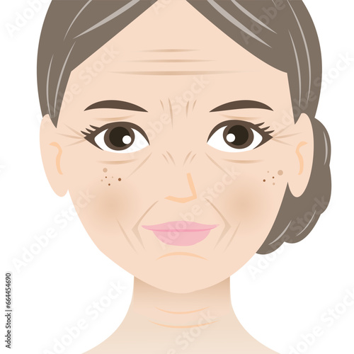 Facial wrinkles woman vector illustration isolated on white background. Forehead, Bunny, Marionette, Frown lines, Mental crease, Crows feet, Tear troughs, Nasolabial folds, Smile and Neck lines.