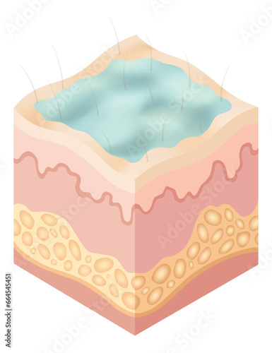 Protection uv ray skin. Illustration about Skin care concept. Sun protection body adipose layers epidermis, vector infographic