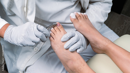 Foot treatment, Chiropody