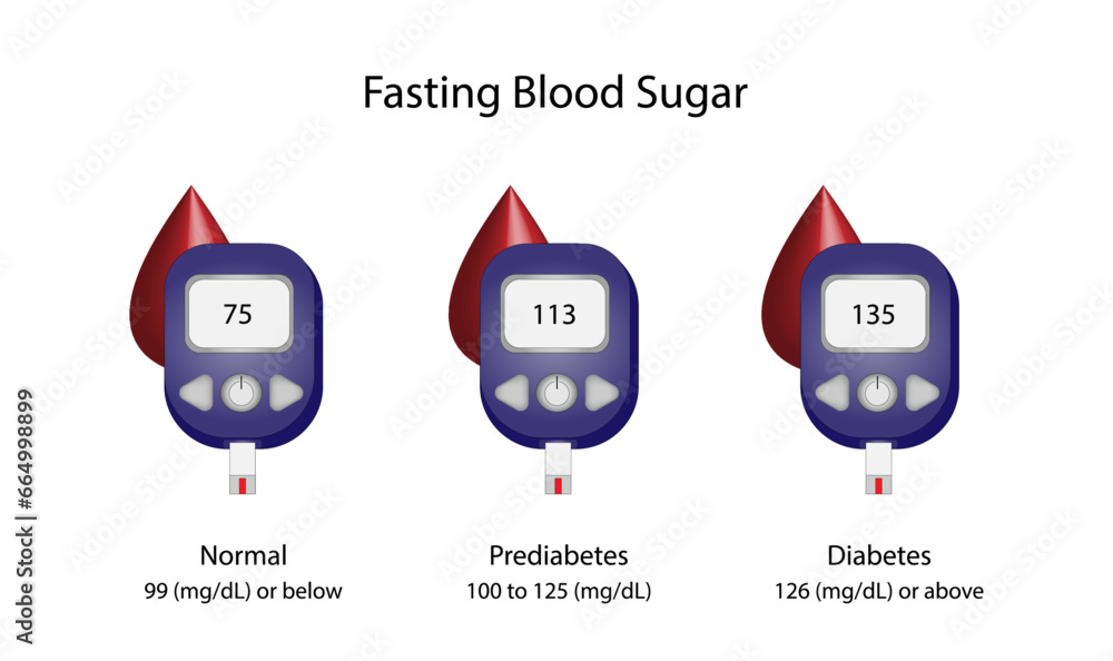 Fasting Blood Sugar Level To Measure Blood Glucose And Diagnose Diabetes Glucometer Medical Fasting Blood Sugar Level To Measure Blood Glucose And Diagnose Diabetes Glucometer Medical