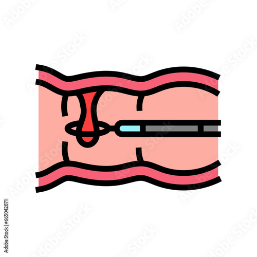colon polyps gastroenterologist color icon vector. colon polyps gastroenterologist sign. isolated symbol illustration