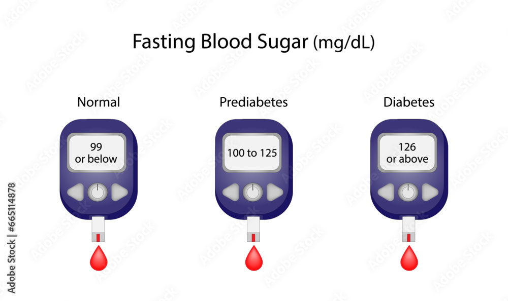 Fasting blood sugar level to measure blood glucose and diagnose