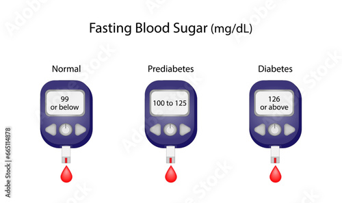 Fasting blood sugar level to measure blood glucose and diagnose diabetes. Glucometer. Medical Equipment for diabetes diagnosis. Vector illustration.