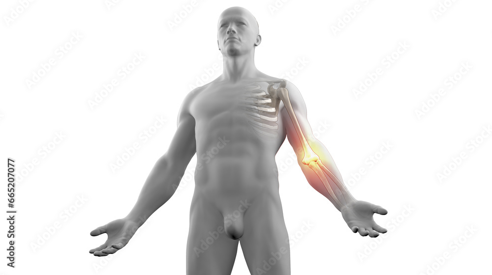 3D medical illustration of skeleton with elbow joint pain 3D medical illustration of skeleton with elbow joint pain