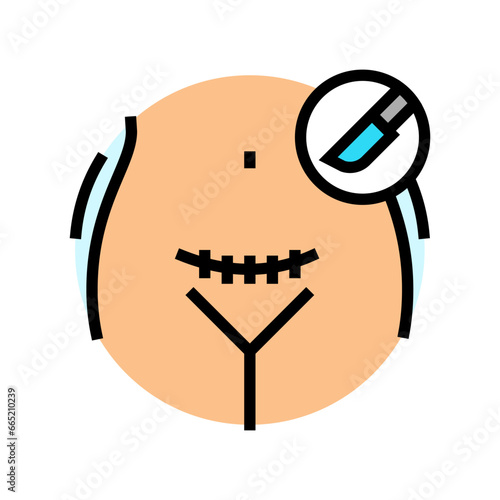 cesarean section gynecologist color icon vector. cesarean section gynecologist sign. isolated symbol illustration