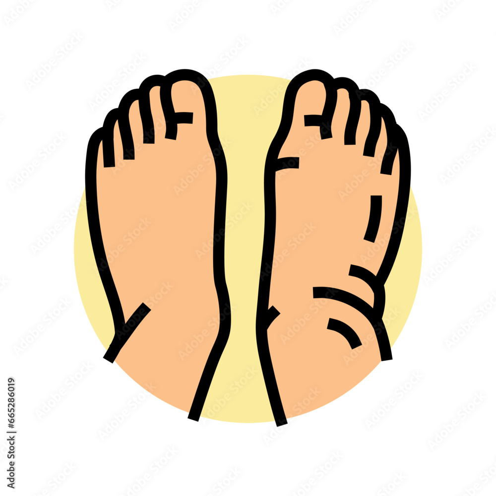 swollen ankles feet disease symptom color icon vector. swollen ankles
