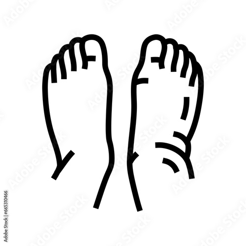 swollen ankles feet disease symptom line icon vector. swollen ankles feet disease symptom sign. isolated contour symbol black illustration