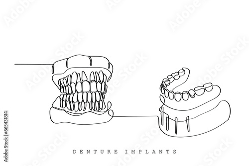  line art of Orthodontic treatment. Dentists day and respect for their services to humanity. Dental procedures vector art concept. Isolated vector of teeth and jaws. Retainers braces denture