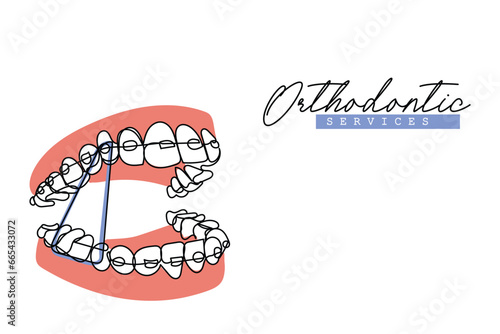  line art of Orthodontic treatment. Dentists day and respect for their services to humanity. Dental procedures vector art concept. Isolated vector of teeth and jaws. Retainers braces denture