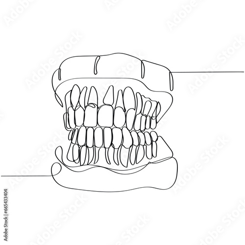  line art of Orthodontic treatment. Dentists day and respect for their services to humanity. Dental procedures vector art concept. Isolated vector of teeth and jaws. Retainers braces denture. dentist.