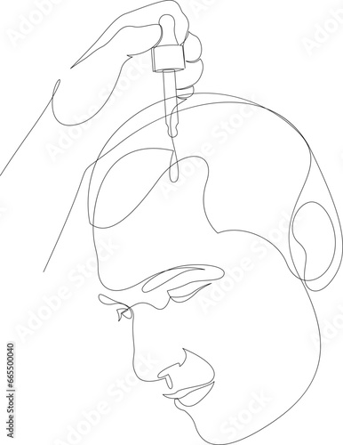 Continuous one line drawing of hand holding pipette with medicine for alopecia and baldness. Applying hair care oil essence to man scalp. Hair loss treatment concept drawn by single line.