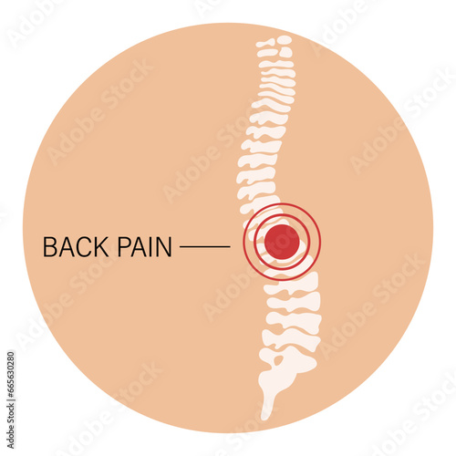 Back pain, spinal pain, osteoarthritis, rheumatoid arthritis. Anatomy of human bones. Medicine. Illustration, vector
