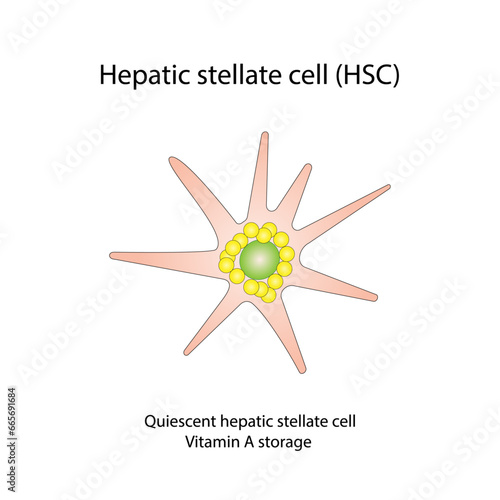 Hepatic stellate cell, HSC. Quiescent HSC vitamin A storage. Hepatic fibrosis. vector illustration 