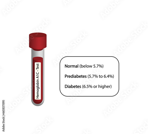 Hemoglobin A1C, HbA1c test results, glycated hemoglobin, A1C Blood Sugar Test, Diabetes Mellitus. Vector illustration.	