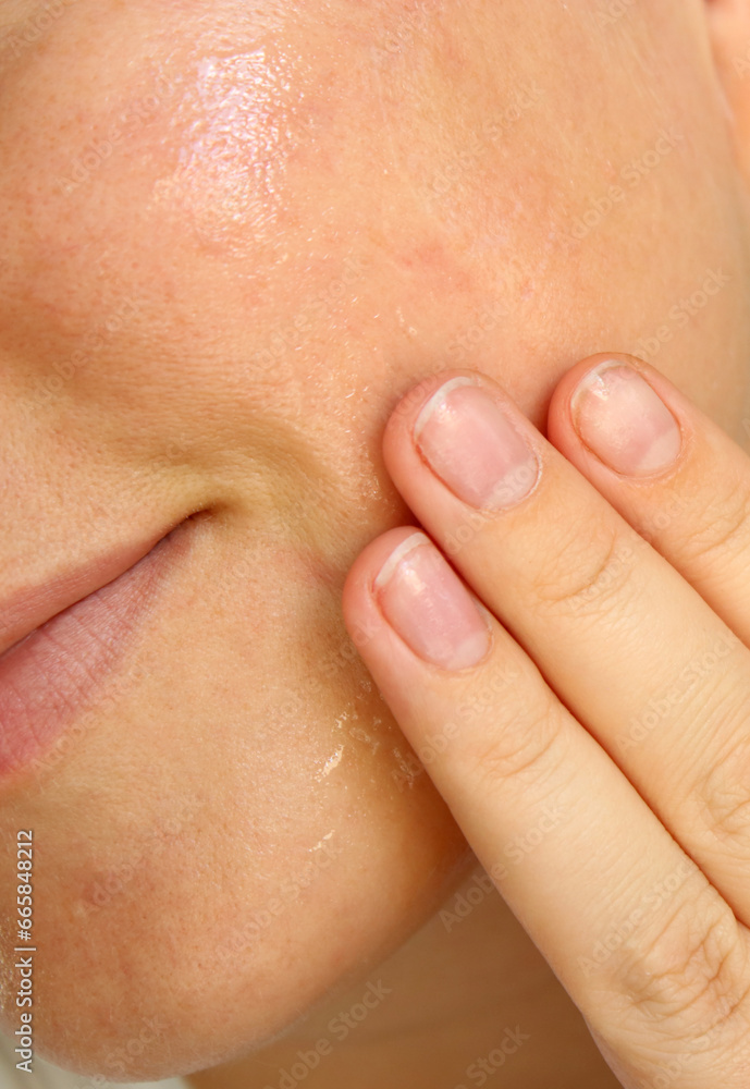 Close up of woman using moisturising skin serum on her face Close up of woman using moisturising skin serum on her face
