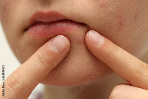 Young woman touching pimple on her face against white background, closeup. Acne problem photo