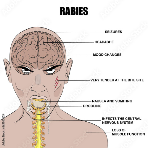 The rabies virus infects the central nervous system.
