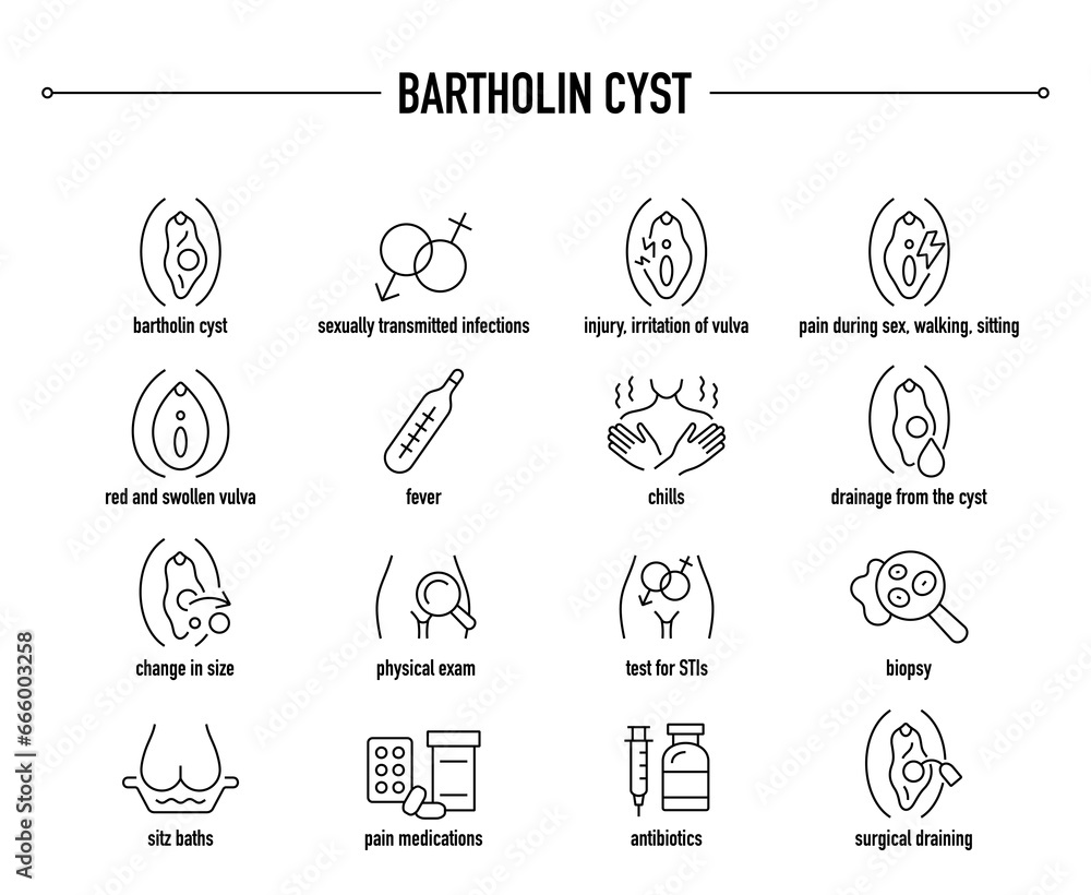 Bartholin Cyst symptoms, diagnostic and treatment vector icons. Line editable medical icons
