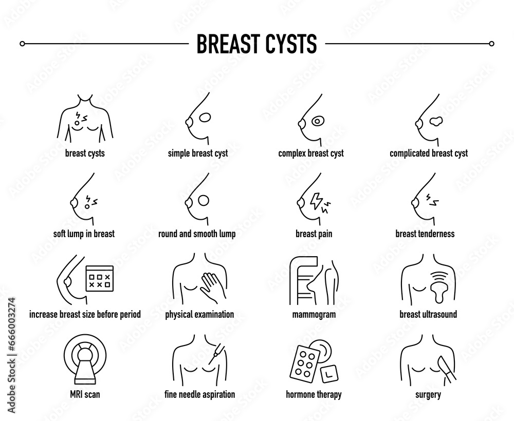 Breast Cysts symptoms, diagnostic and treatment vector icons. Line editable medical icons. Breast Cysts symptoms, diagnostic and treatment vector icons. Line editable medical icons.