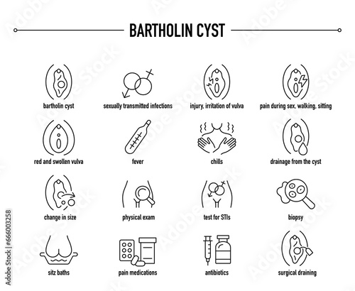 Bartholin Cyst symptoms, diagnostic and treatment vector icons. Line editable medical icons.