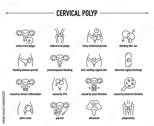 Cervical Polyp symptoms, diagnostic and treatment vector icons. Line editable medical icons. photo