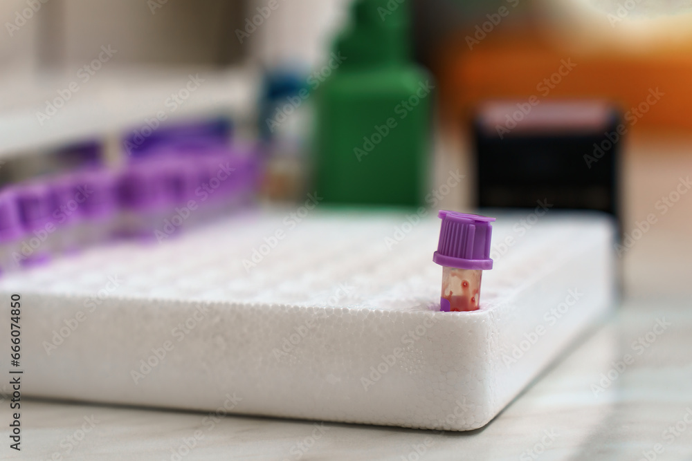 Medical professional worker of lab conducting a laboratory test for viral infections, with a focus on coronavirus detection. White blood test tube rack container on the table