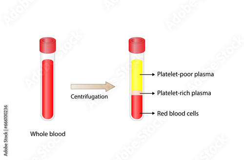Platelet-rich plasma (prp). Autologous conditioned plasma, is a concentrate of platelet-rich plasma extracted from whole blood. After centrifugation, Extract PRP and Inject. Vector Illustration