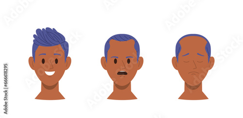 Hair loss stages, steps of baldness male androgenetic alopecia disease infographic isolated on white