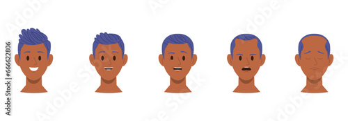 Isolated set of male head with hair loss cosmetology or dermatology aesthetic problem stages