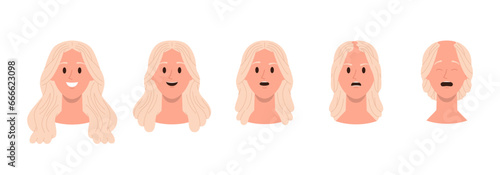 Set of female head with hair loss problem androgenetic alopecia symptom and balding process stages