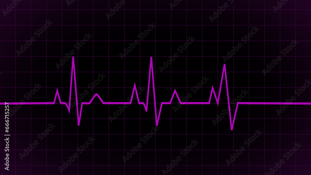 Purple heartbeat line icon. Pulse line, Pulse trace. ECG and Cardiac symbol. Emergency ecg monitoring. purple glowing neon heart pulse. Heart beat. Electrocardiogram. Health and Medical concept. Purple heartbeat line icon. Pulse line, Pulse trace. ECG and Cardiac symbol. Emergency ecg monitoring. purple glowing neon heart pulse. Heart beat. Electrocardiogram. Health and Medical concept.