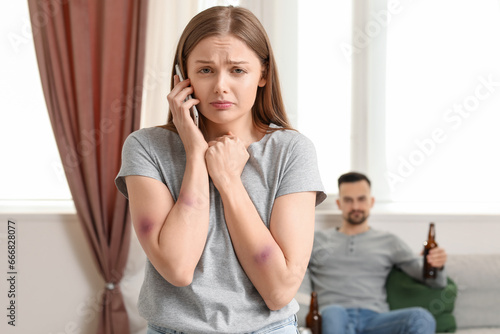 Bruised young woman talking...