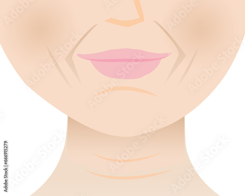 The lower face wrinkled skin of mature woman vector illustration. Marionette lines, Nasolabial folds, Smile lines, Mental crease and Neck lines. Deep aging wrinkles on face. Skin problem concept.