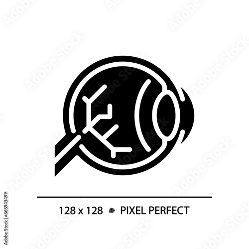 2D pixel perfect glyph style eyestrain icon, isolated simple vector, silhouette illustration representing eye care.