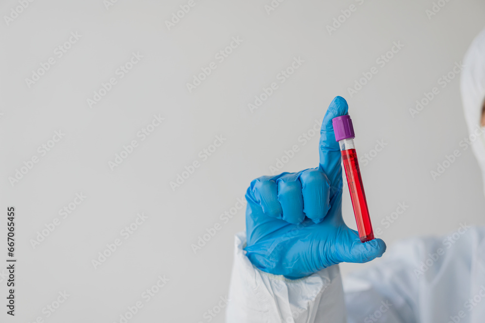 Asian hematologist examines medically necessary blood tests Ordered by a doctor according to Medicare guidelines, attempt to diagnose Blood tests, laboratory services Close-up pictures - obrazy, fototapety, plakaty 