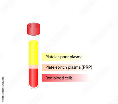 Platelet-rich plasma (prp). Autologous conditioned plasma, is a concentrate of platelet-rich plasma extracted from whole blood. After centrifugation, Extract PRP and Inject. Vector Illustration