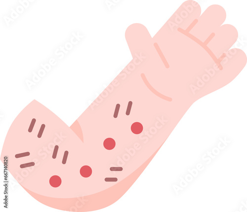 rash  icon