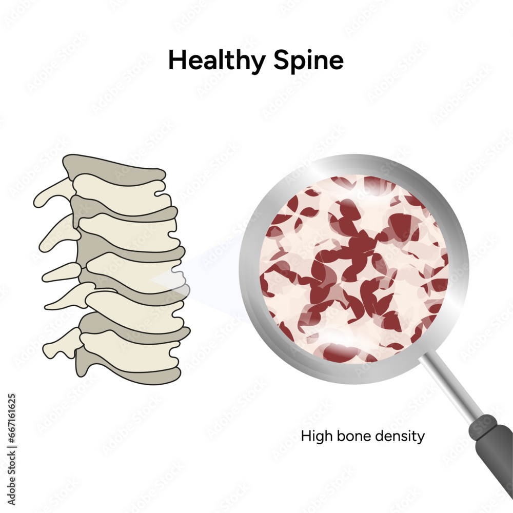 Fotografie Healthy spine high bone density infographic in vector