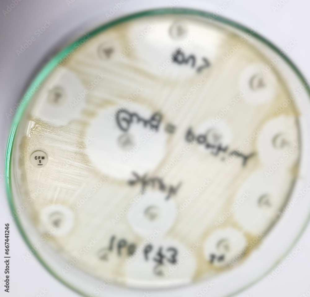 Antimicrobial susceptibility testing in culture plate. Drug sensitivity ...