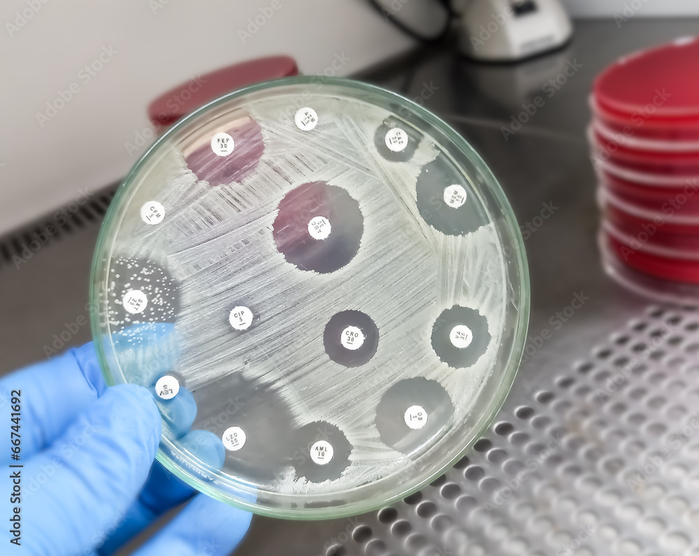 Antimicrobial susceptibility testing in culture plate. Drug sensitivity