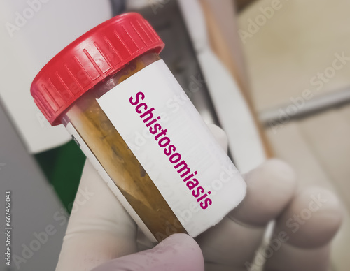 Fecal sample for Real time PCR Bilharzia test to diagnosis of schistosomiasis. photo