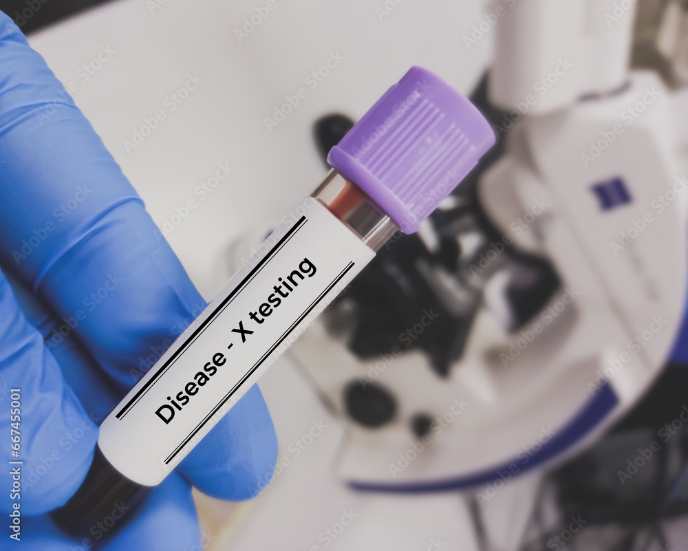 Blood sample for Disease X test. Disease X is the mysterious name given to the very serious threat that unknown viruses pose to human health.