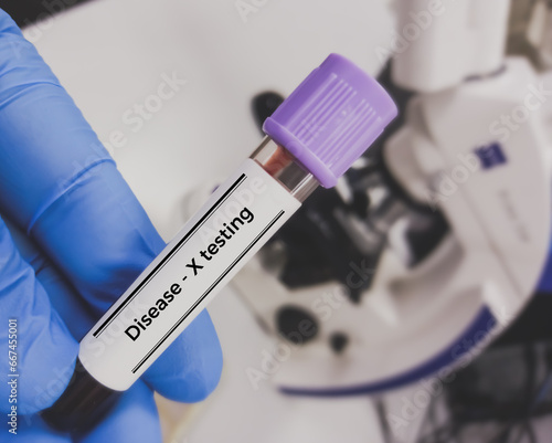 Blood sample for Disease X test. Disease X is the mysterious name given to the very serious threat that unknown viruses pose to human health. photo