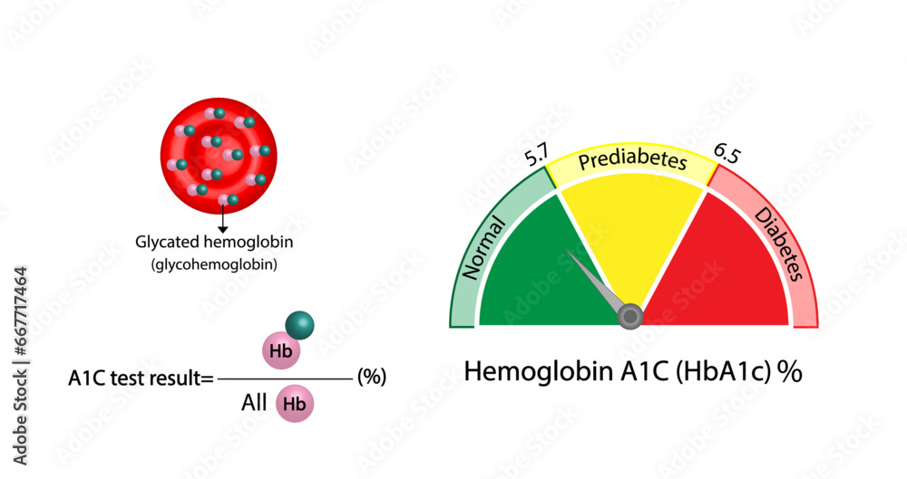 Hemoglobin A1C, HbA1c test , HbA1c levels, Glucose sticks to hemoglobin