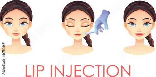 Vector cartoon illustration of beauty procedures, lip augmentation with hyaluronic acid injection. Avatar of girl with narrow and plump lips